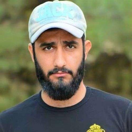 محمد امیری لعنت به عشق زوری دور چشام کبودی